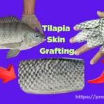 tilapia skin in burn treatment