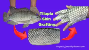 tilapia skin in burn treatment